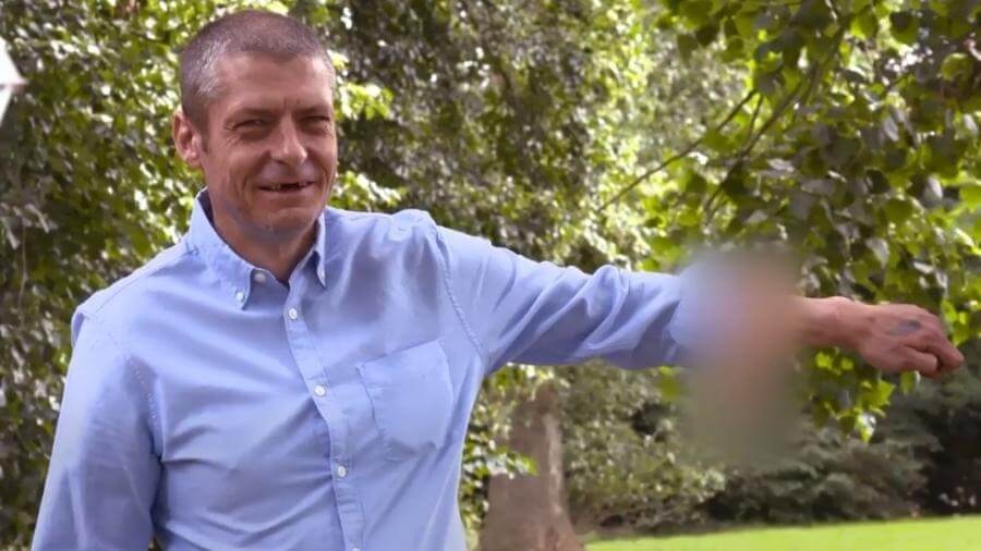 HHomem com pênis no braço. (Foto: Reprodução/The Sun)