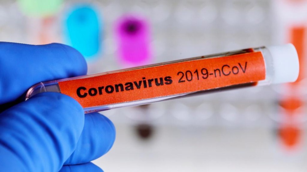 As equipes de vigilância epidemiológica isolaram pessoas que tiveram com contato ao idoso na clínica da cidade - os chamados comunicantes