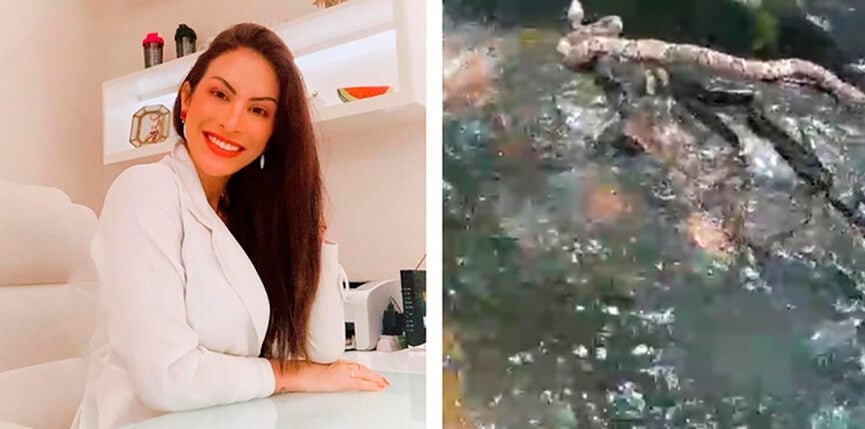 Médica é picada por cobra jararaca em MT. (Foto: Reprodução)