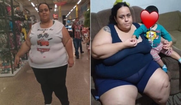 Jundiaiense com mais de 150 quilos pede ajuda para cirurgia: “Quero viver”