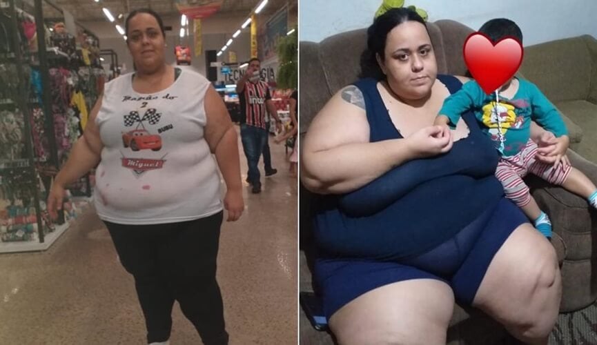 Jundiaiense com mais de 150 quilos pede ajuda para cirurgia: “Quero viver”