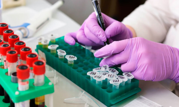 Cientistas analisa amostras em laboratório