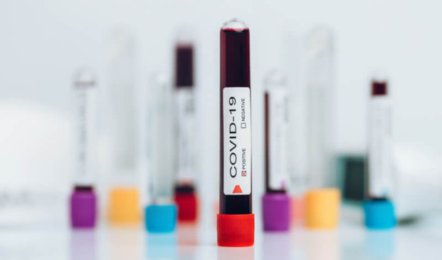 Tubos de sangue de covid-19