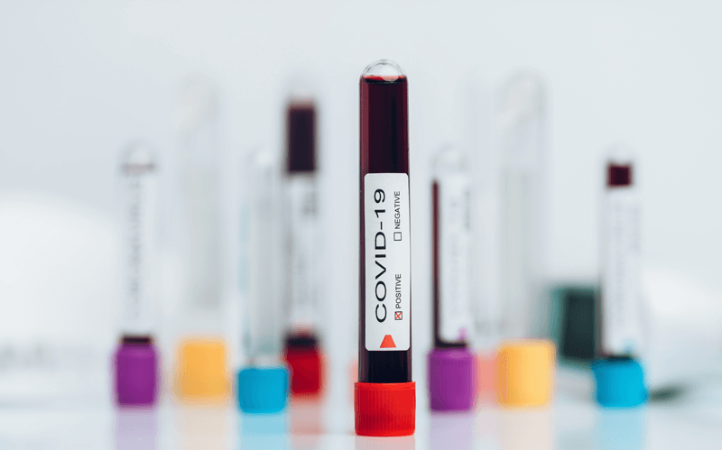 Tubos de sangue com Covid-19 Tubos de sangue com Covid-19