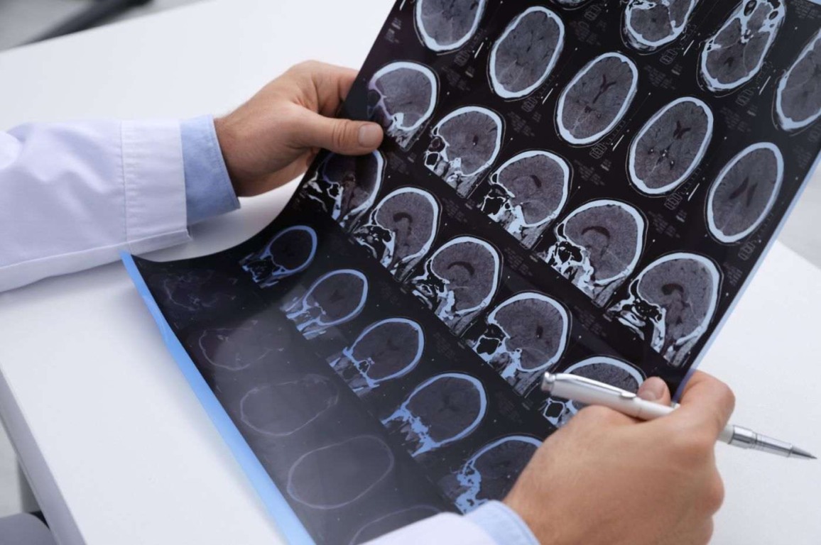 Foto: Canva Foto: Canva