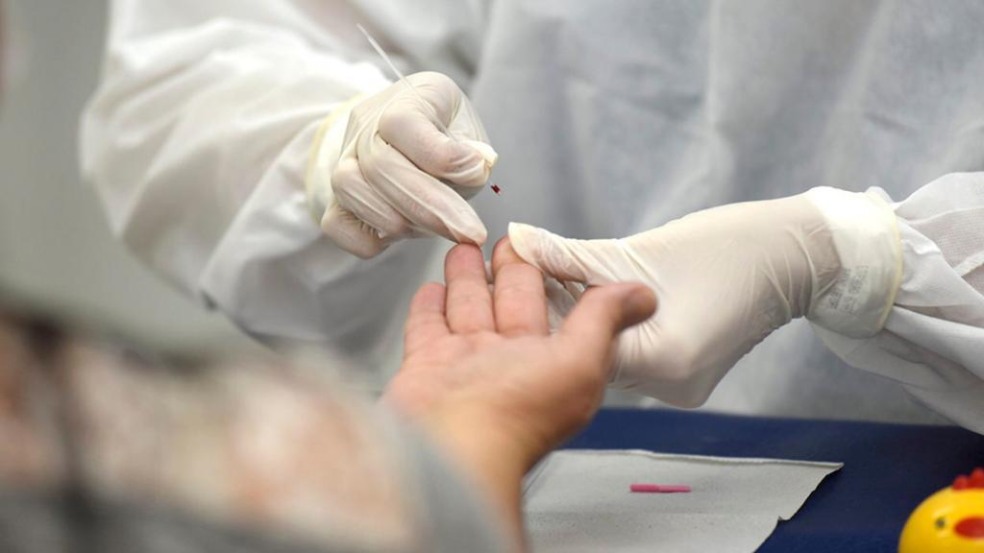 "Seguimos testando mais do que qualquer outro município brasileiro em relação ao número de habitantes", diz prefeito (Foto: Envato Elements)