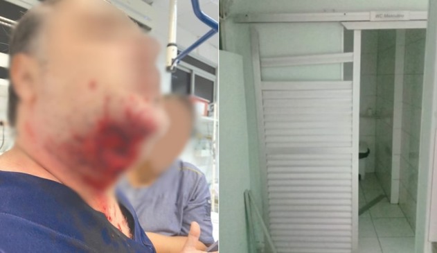 Homem com mordida no pescoço, à esquerda; porta de banheiro quebrada, à direita