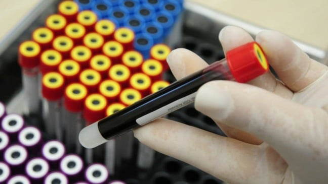 Exame de sangue PSA é colhido em todas as UBSs para os casos indicados