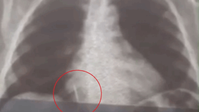 Foto: Reprodução/G1