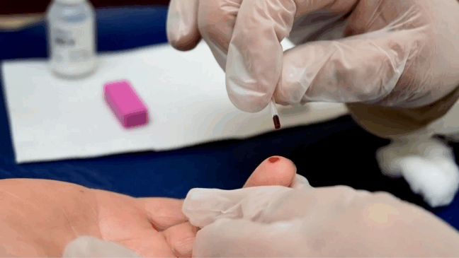 Hepatite: diagnóstico e tratamento para a prevenção da doença silenciosa