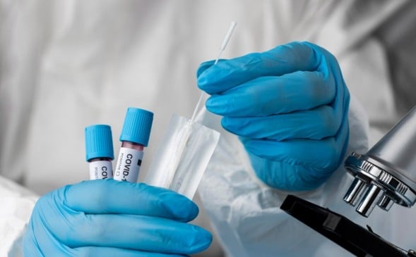 Brasil confirma primeiro caso da variante ômicron XE