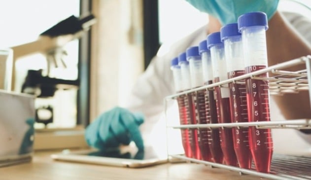 Tubos de ensaio com sague