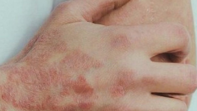 Foto: Divulgação/Universidade Federal de Alagoas