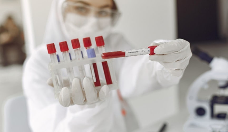 Mulher em laboratório com testes de covid-19