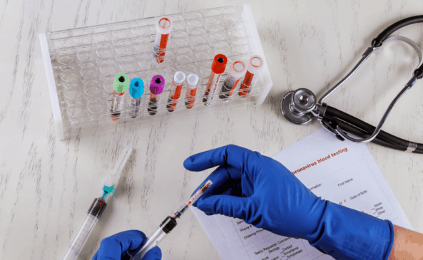 Pesquisador faz análise de amostras de sangue