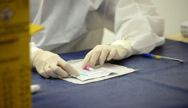 Foto de teste de coronavírus