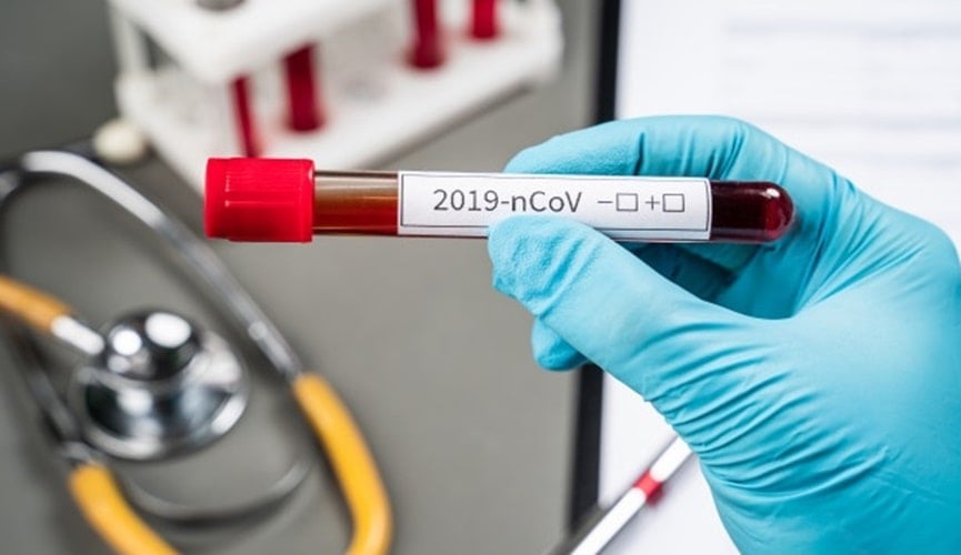 Foto de tubo de exame de sangue