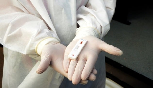 Foto de teste de covid-19