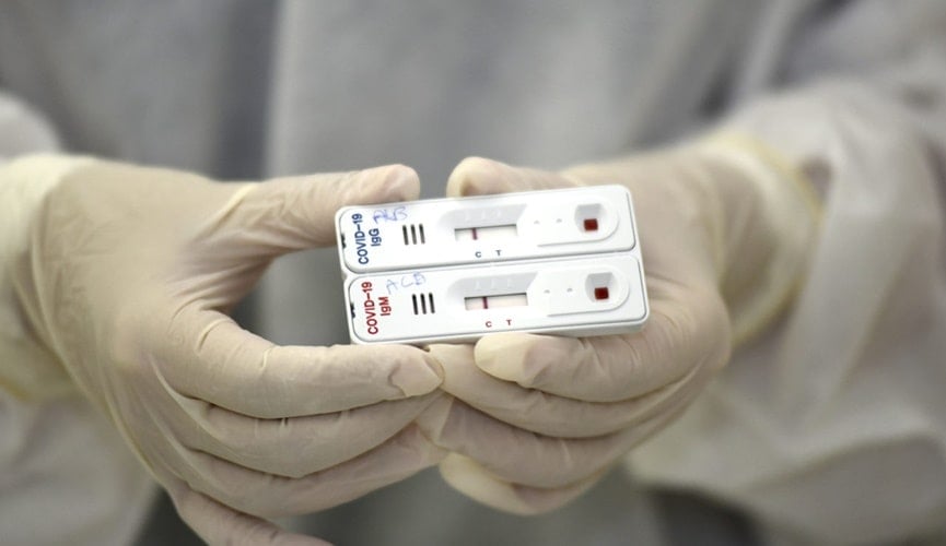 Foto de teste rápido do novo coronavírus