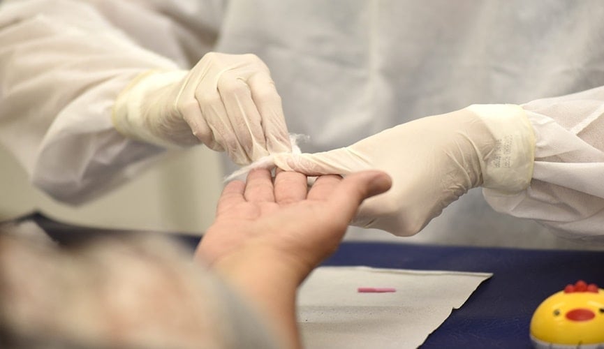 Foto de teste rápido de Covid-19 Foto de teste rápido de Covid-19