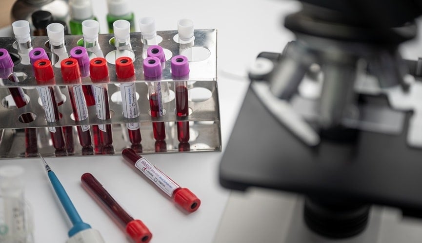 Foto de laboratório