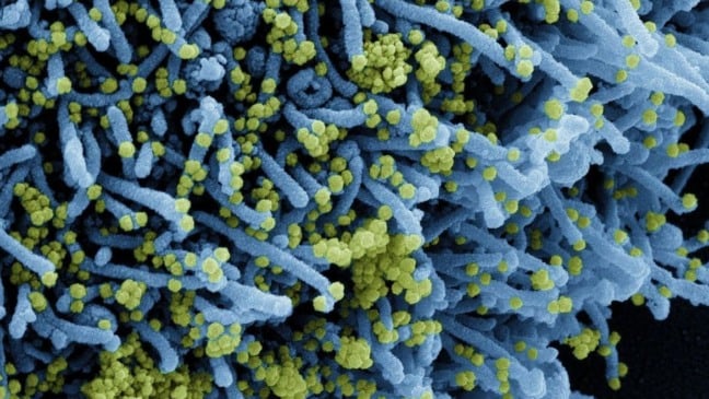 Foto: National Institute of Allergy and Infectious Diseases/NIAID/Direitos Reservados