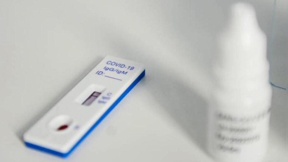 Várzea Paulista vai acionar Ministério Público contra empresa que vendeu testes rápidos