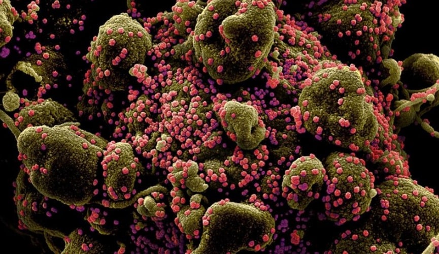 Foto de células Foto de células