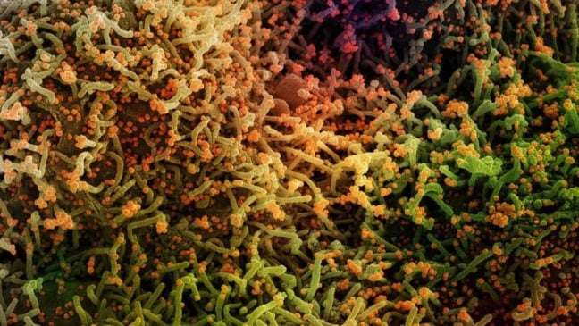 Imagem de microscópio eletrônico de célula humana infectada por partículas do coronavírus Sars-CoV-2 Foto: NIAID-NIH