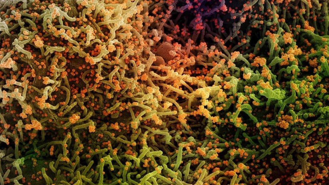 Imagem de microscópio eletrônico de célula humana infectada por partículas do coronavírus Sars-CoV-2 Foto: NIAID-NIH Imagem de microscópio eletrônico de célula humana infectada por partículas do coronavírus Sars-CoV-2 Foto: NIAID-NIH