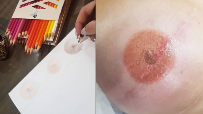 Tatuadora de Jundiaí oferece reconstrução de aréolas para mulheres que superaram o câncer de mama