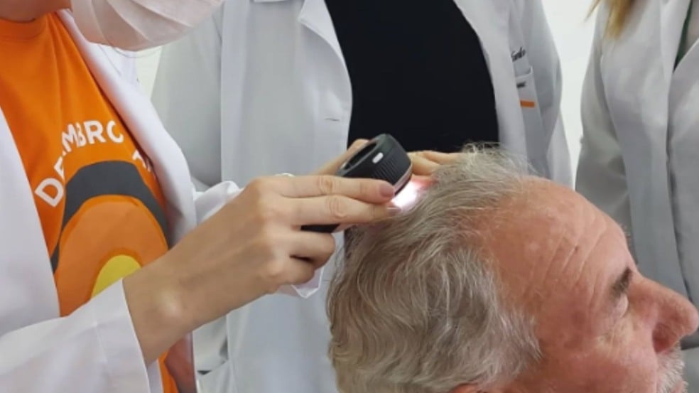 Exame de câncer de pele.