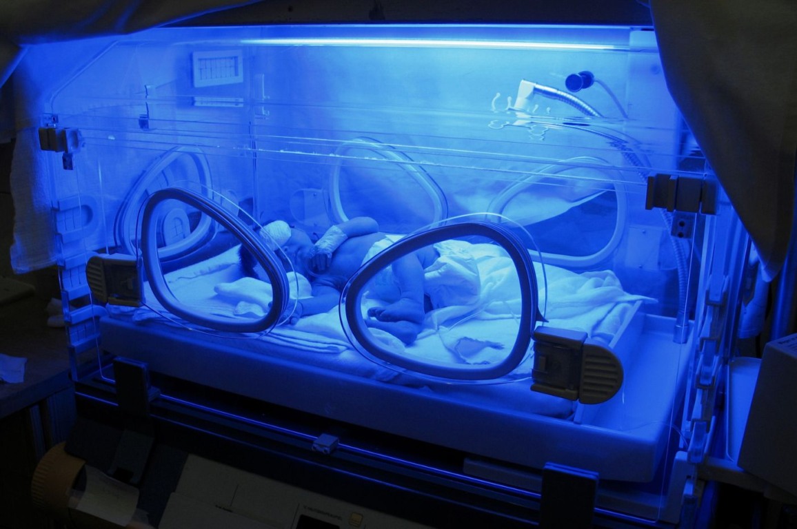 bebê em incubadora bebê em incubadora