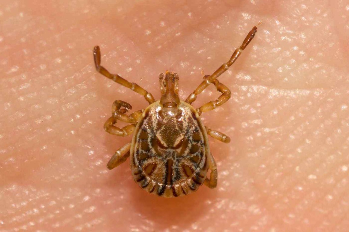 Carrapato-estrela sobre a pele humana, vetor responsável pela transmissão da febre maculosa. Carrapato-estrela sobre a pele humana, vetor responsável pela transmissão da febre maculosa.