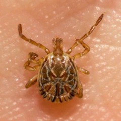 Carrapato-estrela sobre a pele humana, vetor responsável pela transmissão da febre maculosa.