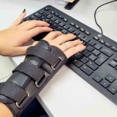 Pessoa digitando em teclado de computador com o bra&ccedil;o imobilizado por uma &oacute;rtese ortop&eacute;dica no antebra&ccedil;o, em ambiente de escrit&oacute;rio.